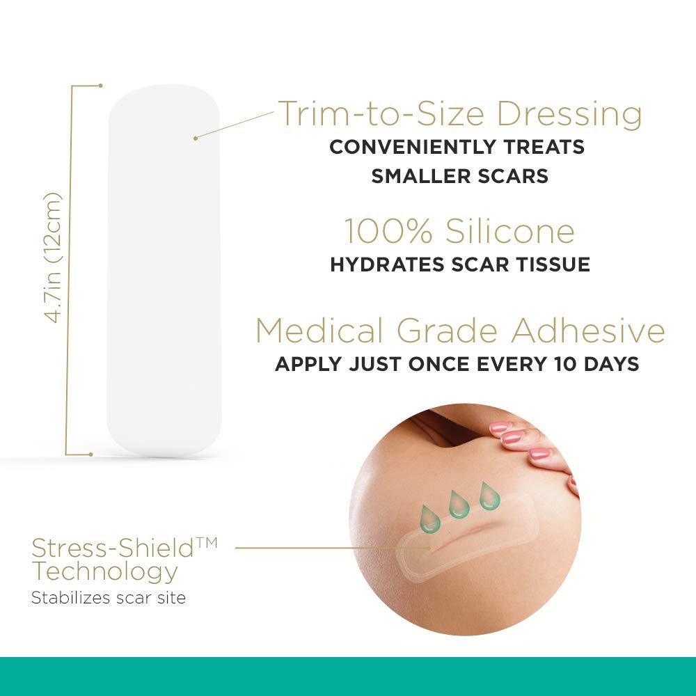 Embrace Minimize for Old Scars