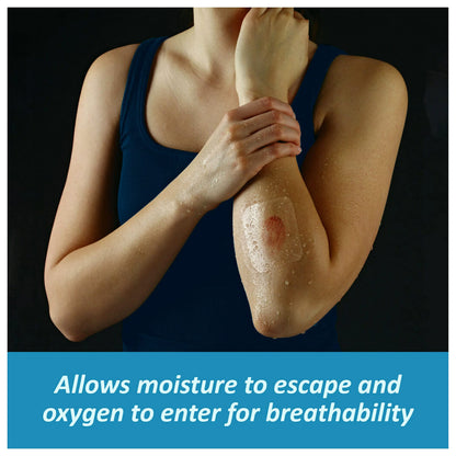 Nexcare Tegaderm Waterproof Transparent Dressing, Dirtproof, Germproof, Provides Protection to Minor Burns, Scrapes, Cuts, Blisters and Abrasions