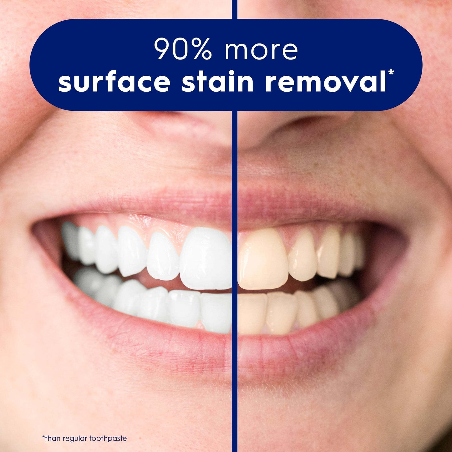 Crest Oral Care, Advanced Anticavity Toothpaste, Glamorous White, 3.3 Ounce