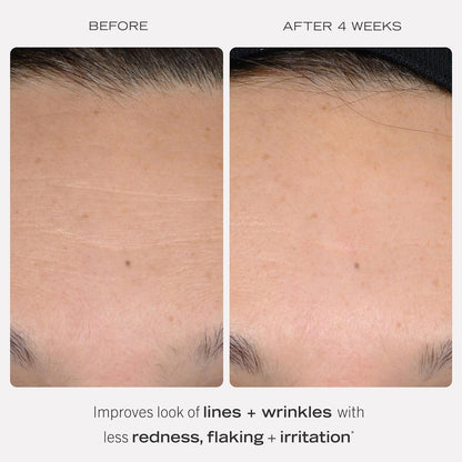 First Aid Beauty - 0.3% Retinol Complex Serum with Peptides, Designed for Sensitive Skin, Helps Visibly Improve Lines and Wrinkles with Less Irritation than Traditional Retinol, Non-Comedogenic, 1 oz