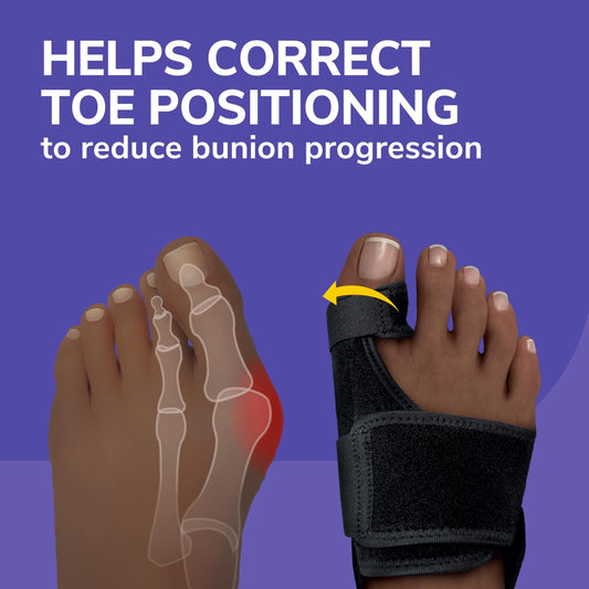 Dr. Scholl's BUNION RELIEF & TOE CORRECTOR // Massaging Gel Bunion Splint & Big Toe Straightener - Orthopedic Bunion Corrector for Women & Men - Bunion Pads for Bunion Pain Relief, 1 Support Set (Left & Right)